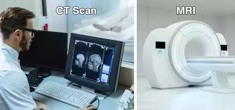 CT Scan vs. MRI: Choosing the Right Imaging Technique